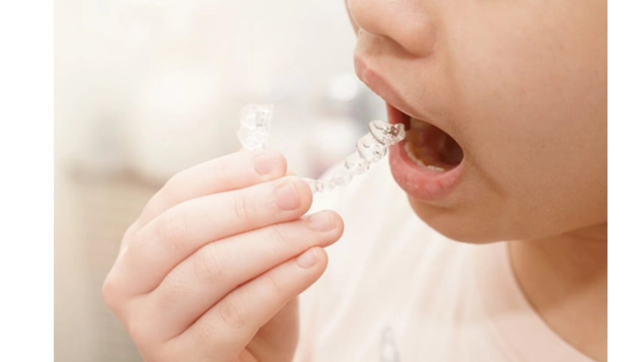 Ortodonti̇ Uzm. Doç. Dr. Bülent Çatalbaş “Düzgün Di̇ş İçi̇n Şeffaf Plak”4