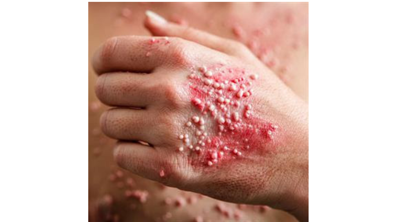 50 Yaş Üstü İçi̇n Kri̇ti̇k Uyari Vücudunuzdaki̇ Vi̇rüs Her An Uyanabi̇li̇r!3