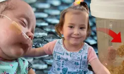 Prematüre Doğan Eliana 131 Gün Yoğun Bakımda Kaldı, Hayatını Balık Derisi Tedavisi Kurtardı