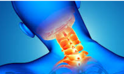 BOYUN FITIĞI (SERVİKAL DİSK HERNİSİ) NEDİR? BELİRTİLERİ VE MODERN TEDAVİ YÖNTEMLERİ