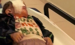 BURSA'DA YÜREK YAKAN OLAY: Torpil Faciası 2 Yaşındaki Çocuğu Ağır Yaraladı