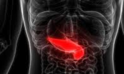 PANKREAS KANSERİ NEDİR? ERKEN TEŞHİS NEDEN ZOR? BELİRTİLERİ VE MODERN TEDAVİ YÖNTEMLERİ