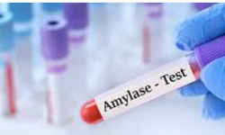 AMİLAZ NEDİR? KRİTİK SİNDİRİM ENZİMİ VE AMİLAZ TESTİ NEDEN YAPILMALIDIR? PANKREAS HASTALIKLARININ ERKEN TEŞHİSİ