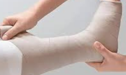 Fil Hastalığı (Lenfödem) Nedir? Belirtileri Nelerdir ve Tedavisi Nasıl Yapılır?