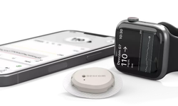 Dexcom G7 fiyatı 2026 ne kadar ve SGK karşılıyor mu?