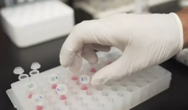 Alzheimer teşhisinde çığır açan kan testi geliştirildi