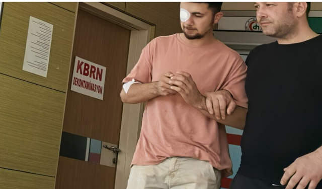 Bursa'da Fabrikada Feci Kaza: Mobilya İşçisi Gözünden Yaralandı