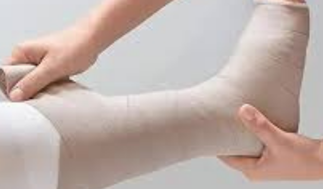 Fil Hastalığı (Lenfödem) Nedir? Belirtileri Nelerdir ve Tedavisi Nasıl Yapılır?